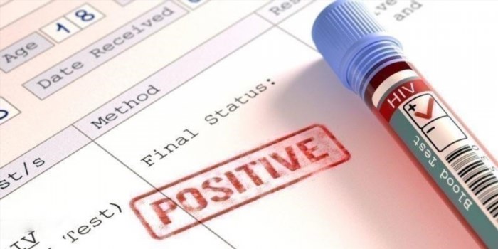 Ý nghĩa của Positive và Negative là gì?